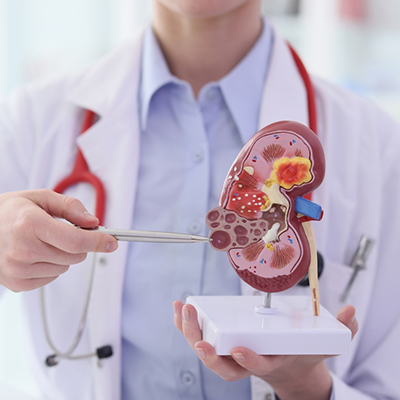 Kidney Specialist in Vijayawada